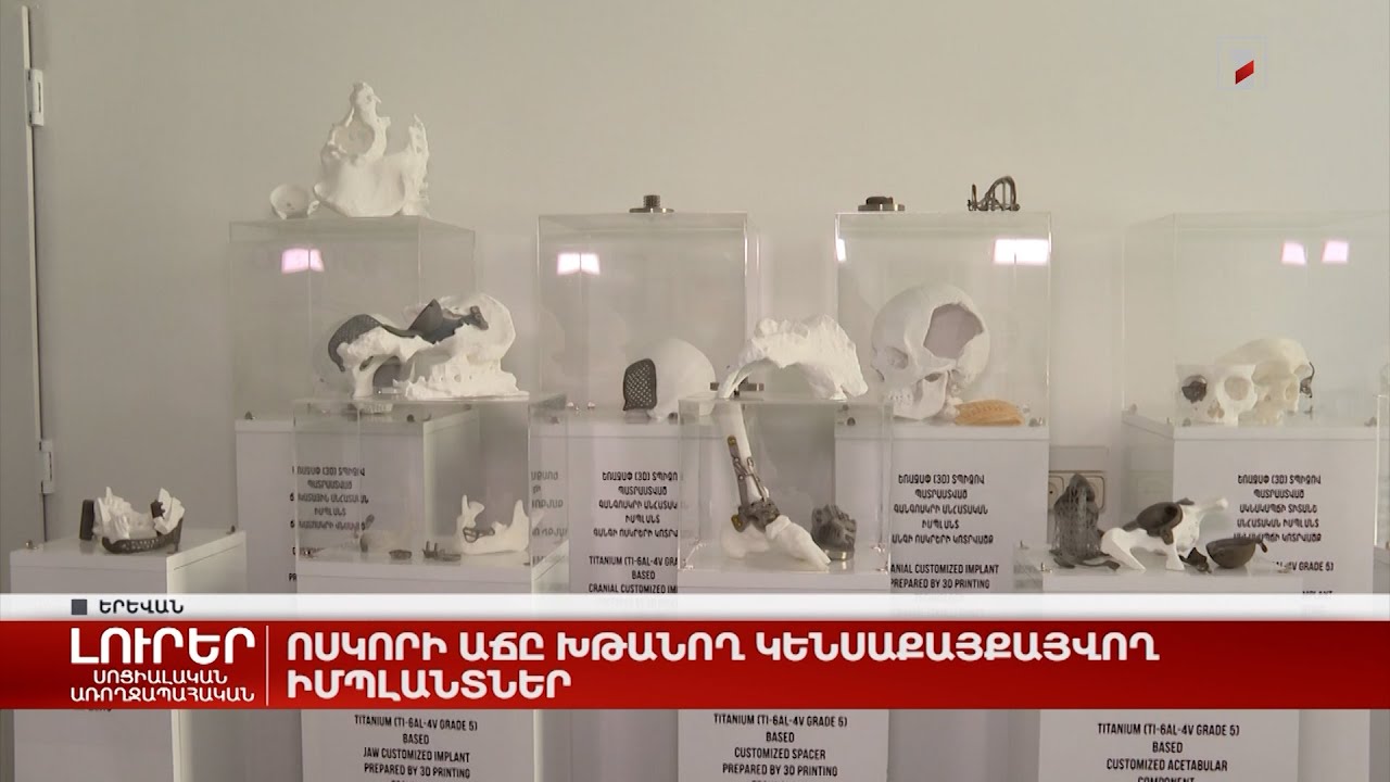 Ոսկու և արծաթի գնի աճը՝ համաշխարհային տնտեսական համակարգի փլուզման նշան